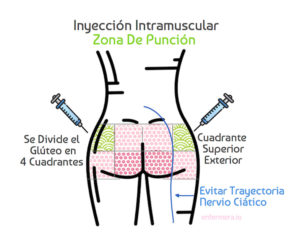 zona de punción intramuscular infografia