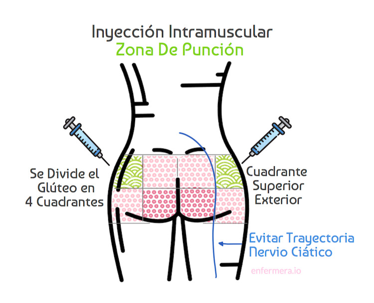 Cuadrante de inyección intramuscular glúteo infografia