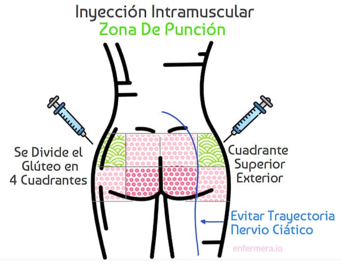 inyección intramuscular portada blog